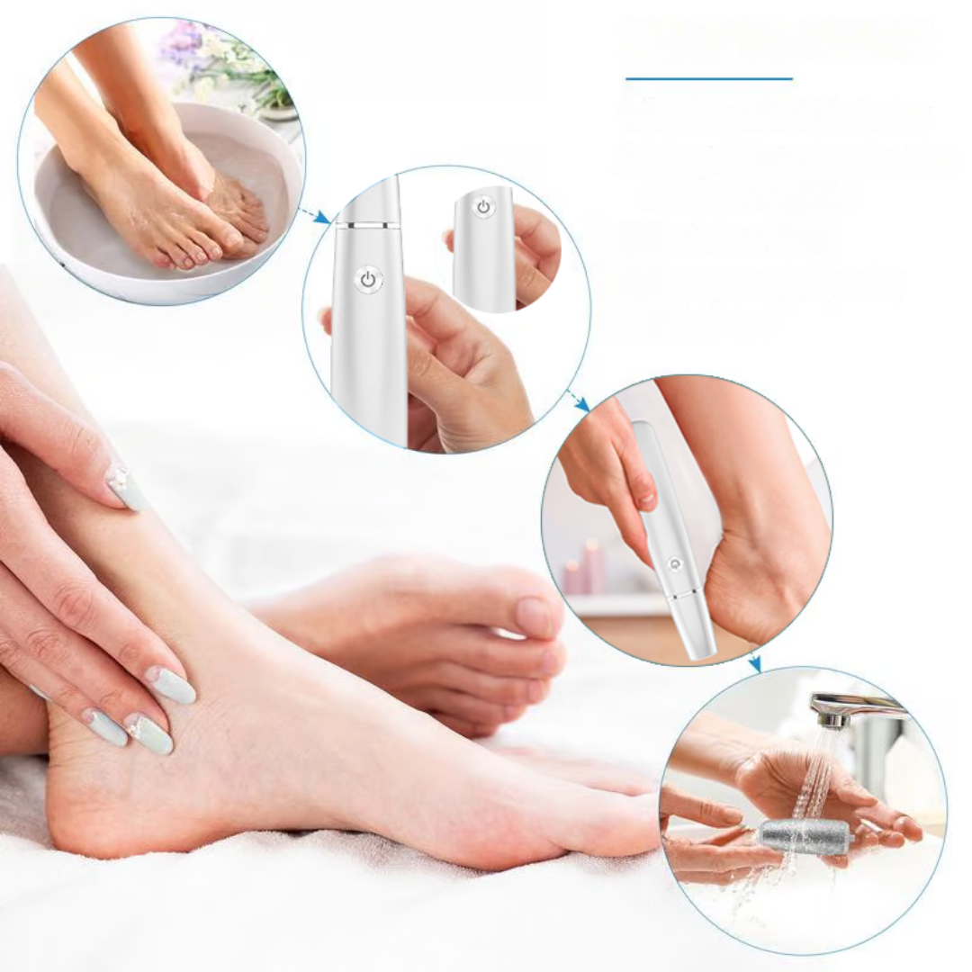 SoleSculpt™ | Schuur. Verzacht. Verwen. Voeten opnieuw geboren!